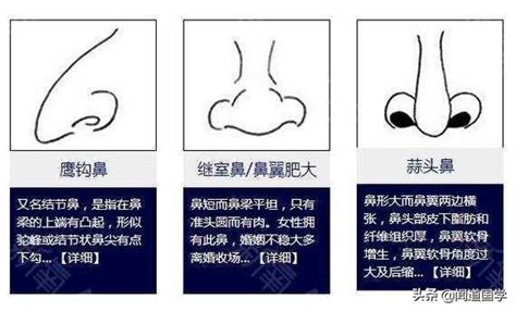 肉鼻子面相|准头、鼻子、鼻翼、鼻梁的面相三六风水网